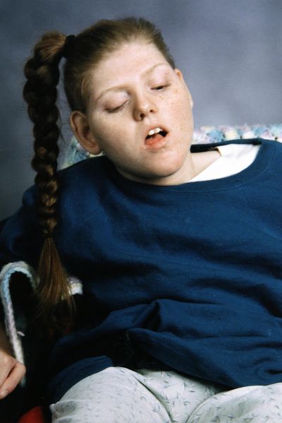 Christina Welch, shown in 2005, was  brain-damaged after her father  shook her when she was 2 months old. She died at age 19.  (Associated Press)