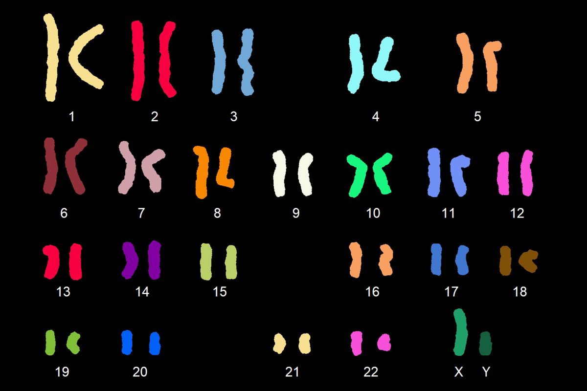 Last week, in a new study in the journal Nature, a team pieced together why and how the breaks occur by studying the fused chromosomes of three people with new genome sequencing technologies. The knowledge is basic science at the moment, unlikely to have an impact on anyone’s health or fertility, but it opens a window into a longstanding fascination in genetics and provides a window into how chromosomes evolve. (Stowers Institute for Medical Research)