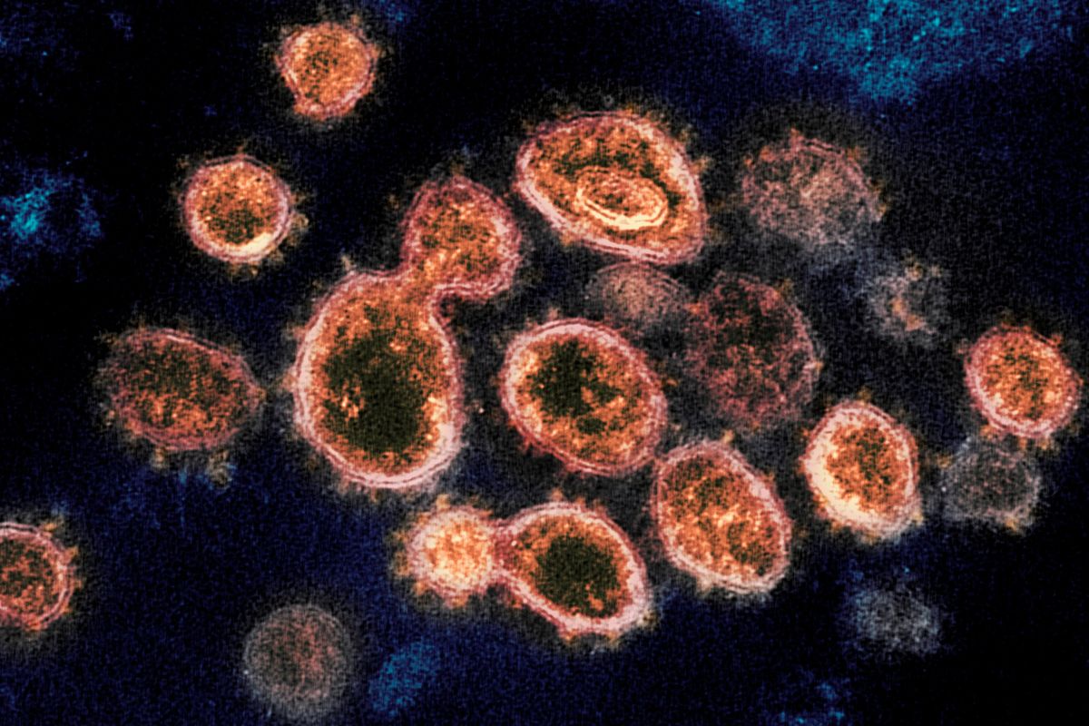 This 2020 electron microscope image provided by the National Institute of Allergy and Infectious Diseases - Rocky Mountain Laboratories shows SARS-CoV-2 virus particles which cause COVID-19, isolated from a patient in the U.S., emerging from the surface of cells cultured in a lab.   (HOGP)