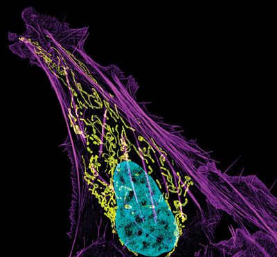 This image from the National Institutes of Health shows an osteosarcoma cell with DNA in blue, mitochondria in yellow and actin filaments, part of the cellular skeleton, in purple.  (National Institutes of Health)