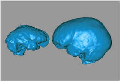 
This computer image provided by the Mallinckrodt Institute of Radiology shows the brain of Homo Floresiensis, left, alongside that of a pygmy. The first detailed study of the fossil's brain, led by Dean Falk of Florida State University, showed little in common between the two. Falk found that H. Floresiensis had its own advanced and primitive features, a combination not seen before. 
 (Associated Press / The Spokesman-Review)