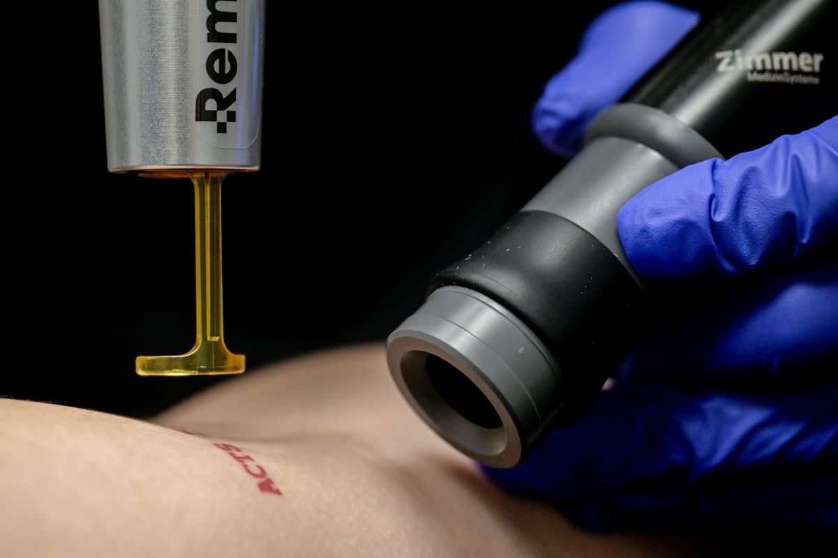 Removery laser technician Jerin Hubert-Posey demonstrates the process of tattoo removal on studio lead and sales consultant Ashley Sullivan at the new location in Spokane on Thursday, November 21, 2025.  (Kathy Plonka/The Spokesman-Review)