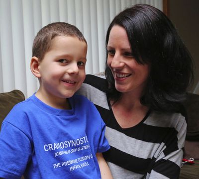 Shelby Davidson is shown with her son, A.J. Davidson, 6, who was born with craniosynostosis.