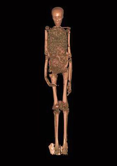 This photo provided by the Supreme Council of Antiquities shows a CT scan of King Tutankhamun’s mummy in Luxor, Egypt.  (File Associated Press)