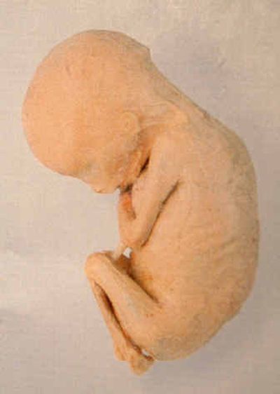 
The California Science Center released this photo Tuesday of a 13-week-old fetus, similar to the one stolen. 
 (Associated Press / The Spokesman-Review)