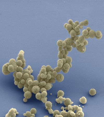 This photo provided by National Center for Imaging and Microscopy Research at the University of California at San Diego shows Electron micrographs of clusters of JCVI-Syn 3.0 cells magnified about 15,000 times. This is the worlds first minimal bacterial cell. Its synthetic genome contains only 473 genes. Surprisingly, the functions of 149 of those genes are unknown. (Associated Press)