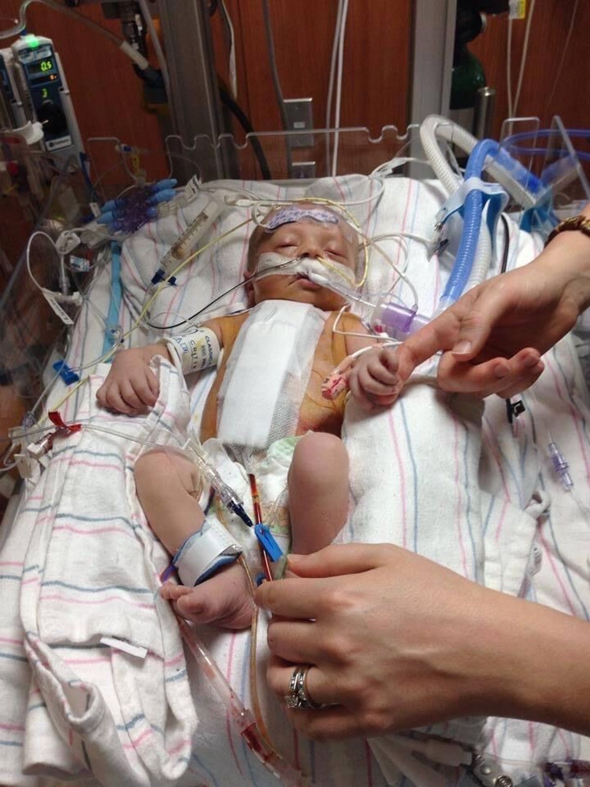 Jack Kramer, now 7, of Liberty Lake has had three heart surgeries. This is after his first surgery shortly after he was born.  (Courtesy of Kramer family)