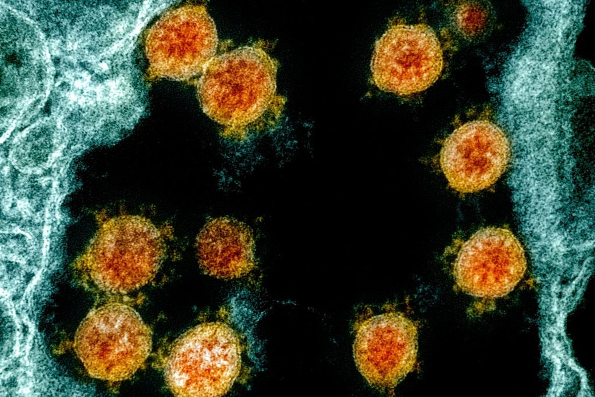 This electron microscope image made available and color-enhanced by the National Institute of Allergy and Infectious Diseases Integrated Research Facility in Fort Detrick, Md., shows Novel Coronavirus SARS-CoV-2 virus particles.  (HOGP)