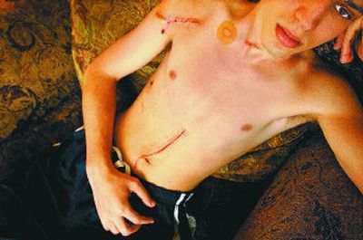University of Idaho student Pete Husmann is recuperating after being shot by a sniper in Moscow who killed three people, then himself.
(Brian Plonka / The Spokesman-Review)