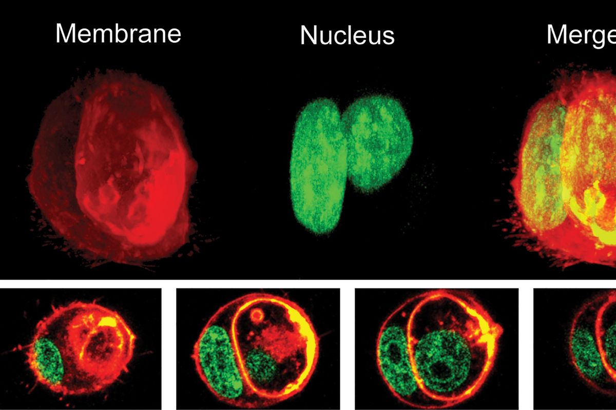 Images provided by Yaron Carmi and Amit Gutwilling show a series of 3D projections, top, and optical slices, bottom, across the height of tumor cells organized in cell-in-cell formation. The cells’ nuclei are color-coded in green and the cells’ membrane is red.  (The Carmi Lab/Tel Aviv University)