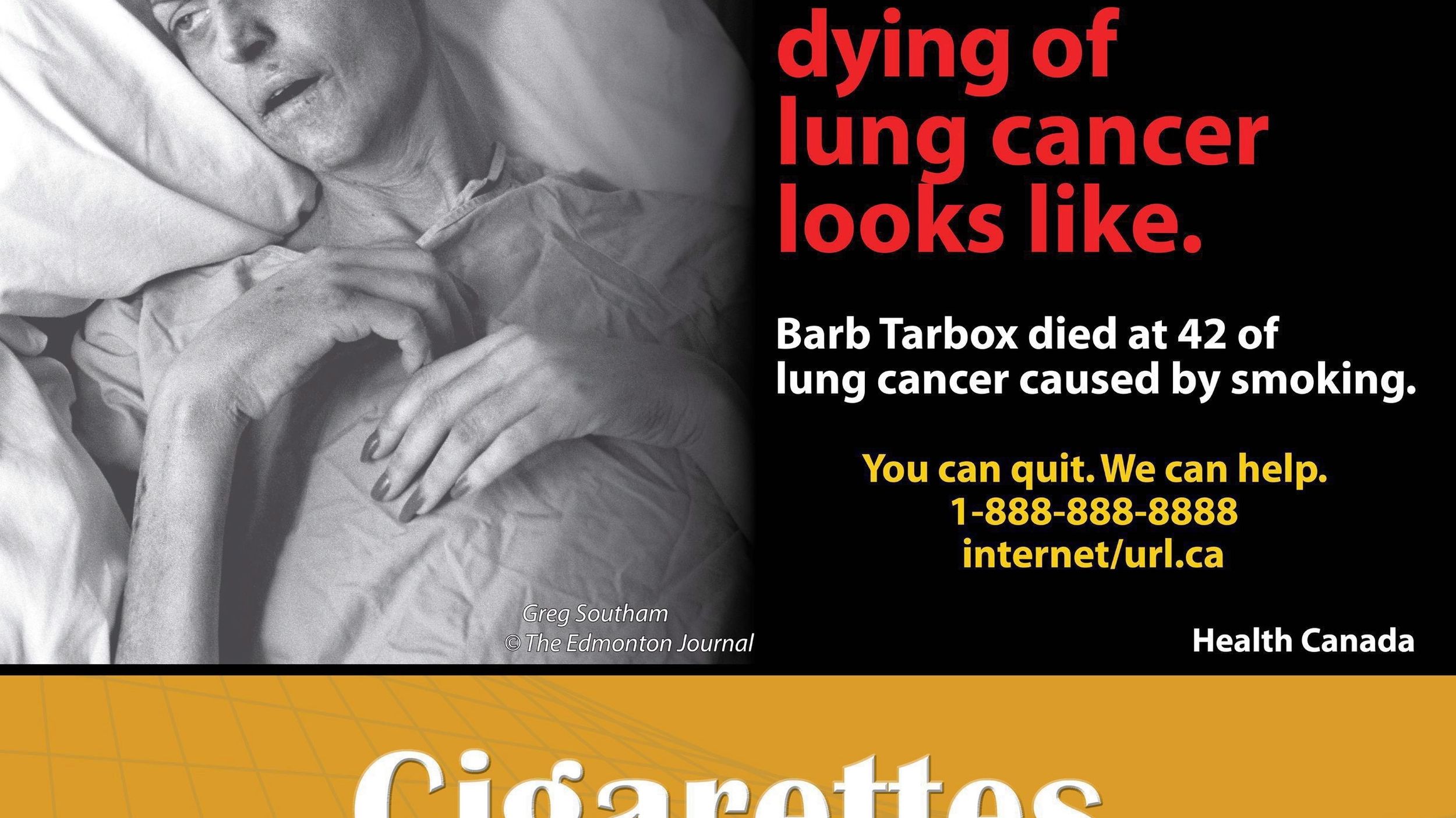 Cancer victim's deathbed image sends message to smokers