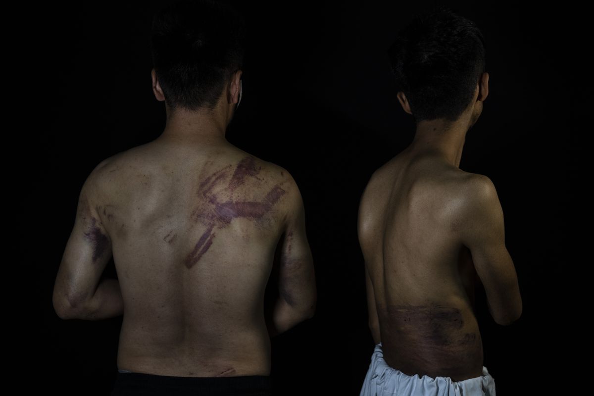 Afghan journalists Neamatullah Naqdi, 28, and Taqi Daryabi, 22, pose for a portrait at Etilaat Roz daily office in Kabul, Afghanistan, Friday, Sept. 10, 2021. The Afghan reporters were detained and beaten by Taliban forces after covering a women