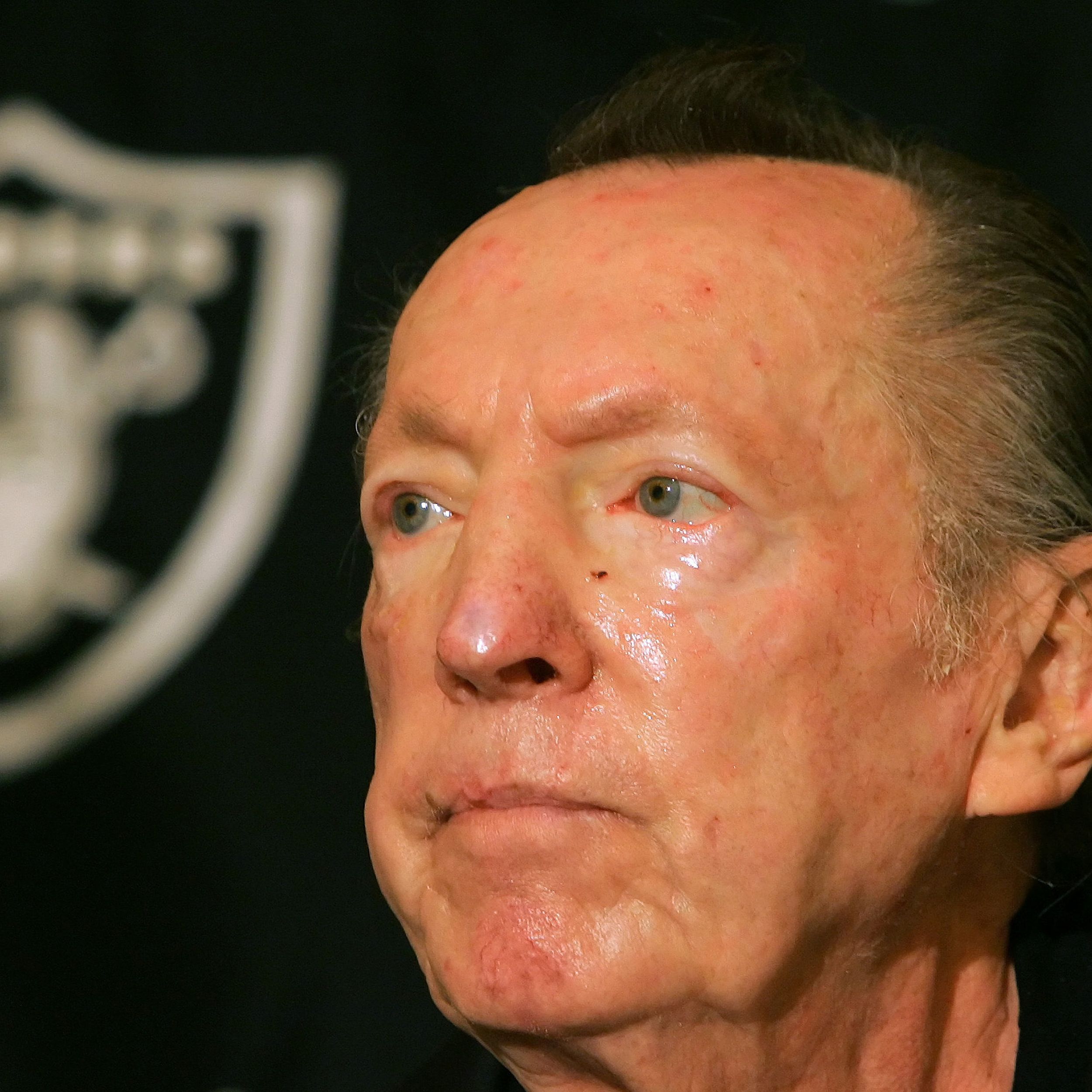 Raiders coaching legend Tom Flores voted into Hall of Fame