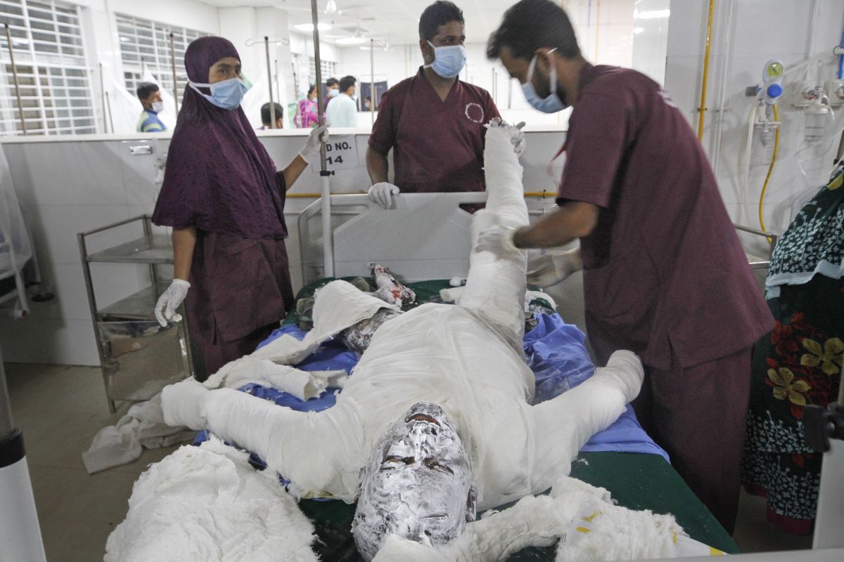 Doctors treat a burn Muslim worshipper in a hospital in Dhaka, Bangladesh, Saturday, Sept. 5, 2020. Dozens of Muslim worshipers suffered burn injuries critically during evening prayers after explosions of a gas pipeline installed underground near a mosque outside Bangladesh capital, officials said Saturday.  (Abdul Goni)