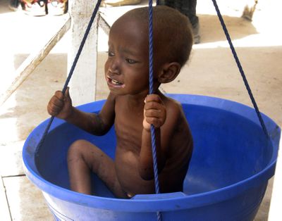 A malnourished Somali child is weighed this week during an aid distribution in Mogadishu, Somalia. The United Nations estimates that tens of thousands of people have died from malnutrition in Somalia in recent months, and more than 11 million people across East Africa need food aid because of a long-running drought. (Associated Press)