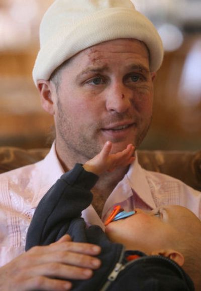 
Timothy Henderson holds his son, Henry, at a hotel in Idaho Falls on Friday, where he was recovering a bear attack. 
 (Associated Press / The Spokesman-Review)