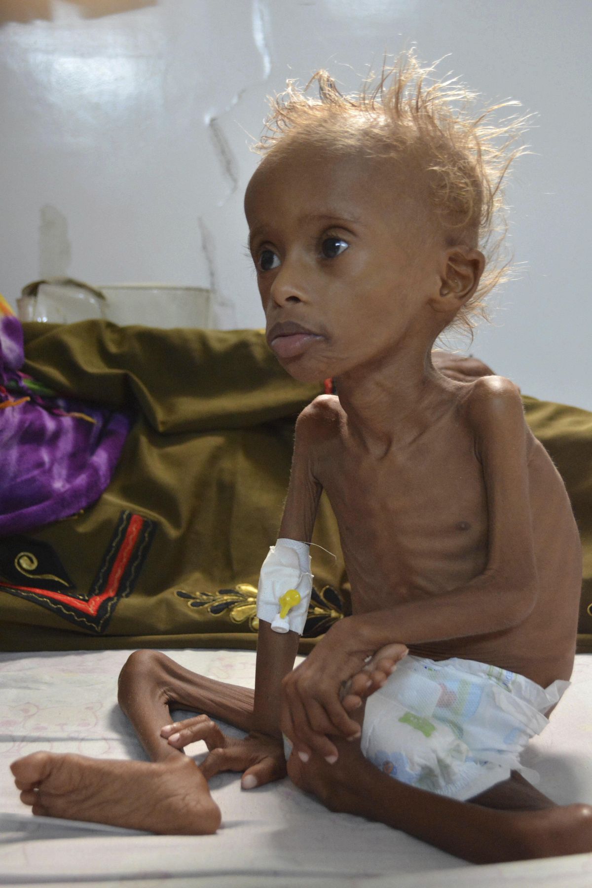 Yemen is on the brink of a horrible famine – here's how things got so bad |  The Spokesman-Review