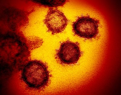An image from an electron microscope shows SARS-CoV-2, the virus that causes COVID-19.   (NIAID-RML/TNS/TNS)