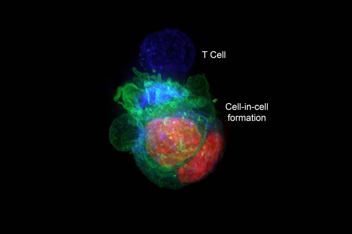 An image provided by Yaron Carmi and Amit Gutwilling shows a 3D projection of tumor cells organized in cell-in-cell formation, with the cells’ nuclei, color-coded in red, and membrane, in green, being attacked by a T-cell, in blue. In a surprise discovery, researchers found that cells from some types of cancers escaped destruction by the immune system by hiding inside other cancer cells.   (The Carmi Lab/Tel Aviv University)