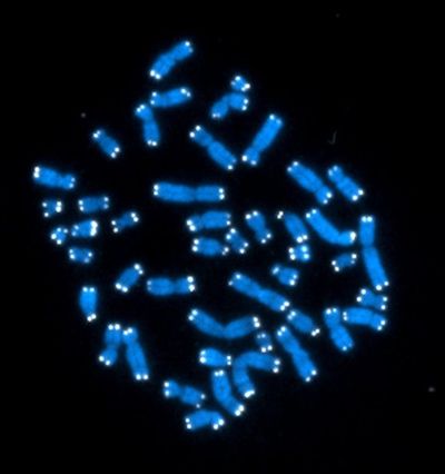 This undated image provided by the U.S. National Cancer Institute shows the 46 human chromosomes, where DNA resides and does its work. (AP)