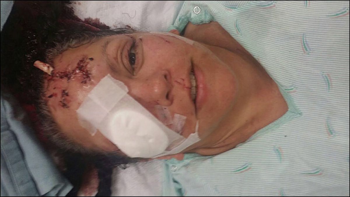 Lelani Grove suffered bites requiring hundreds of stitches as she rescued her grandson from an otter attack in Washington