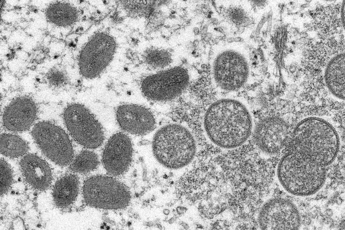 This 2003 electron microscope image shows mature, oval-shaped monkeypox virions, left, and spherical immature virions, right, obtained from a sample of human skin associated with the 2003 prairie dog outbreak.  (Centers for Disease Control and Prevention)