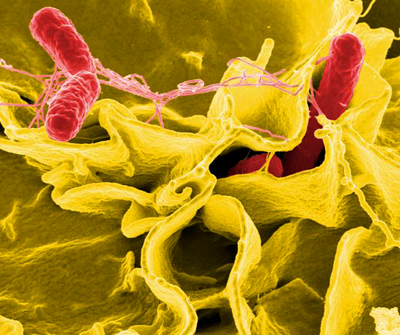 This digitally colorized scanning electron microscopic image depicts a number of red-colored, Salmonella sp. bacteria as they were in the process of invading a mustard-colored, ruffled immune cell.  (National Institute of Allergy and Infectious Diseases)